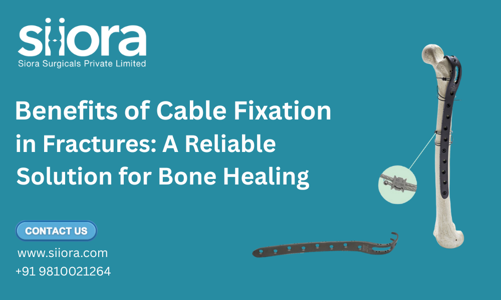 Benefits of Cable Fixation in Fractures: A Reliable Solution for Bone ...